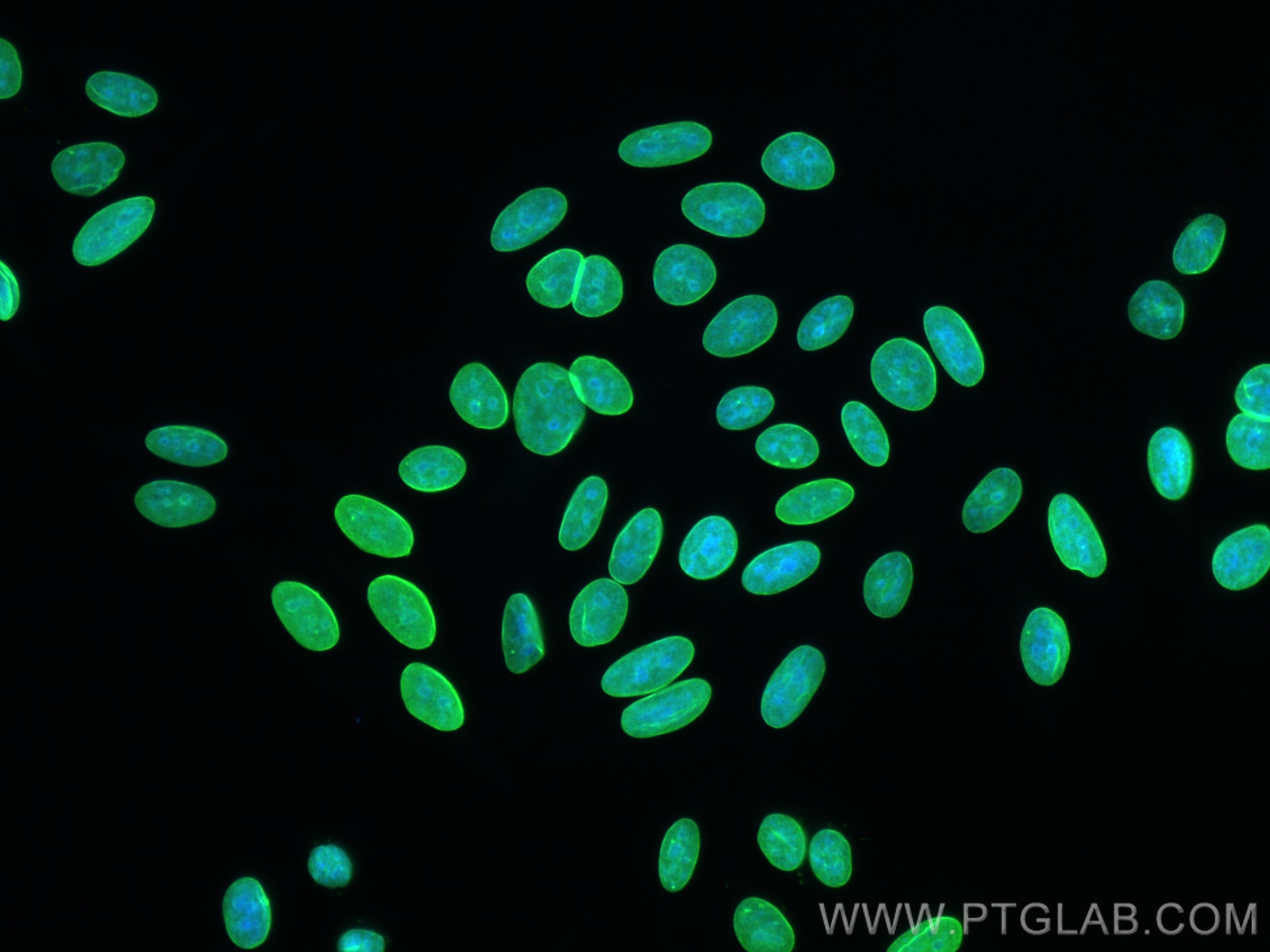 Immunofluorescence (IF) / fluorescent staining of HepG2 cells using Lamin A/C Recombinant antibody (81042-1-RR)