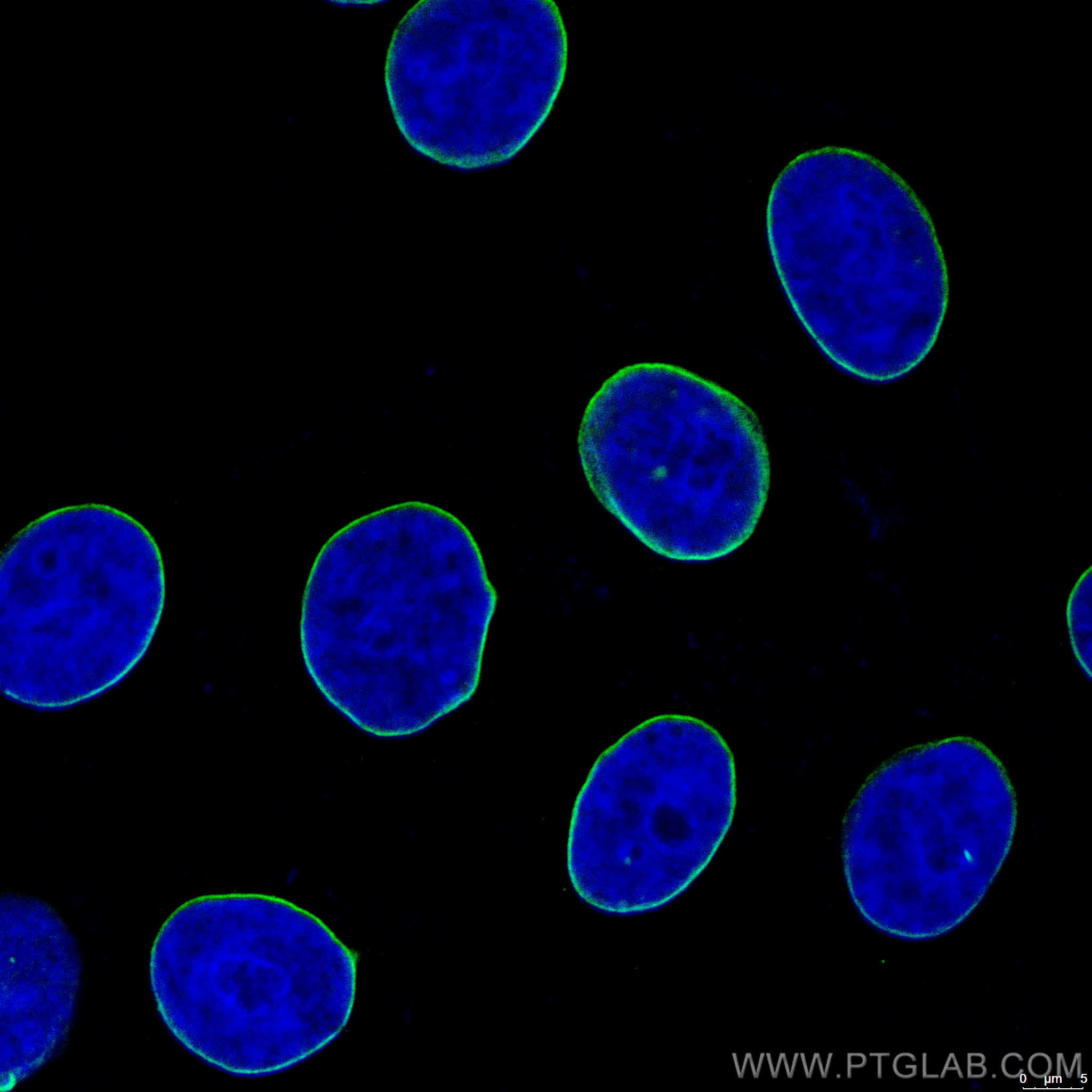 Immunofluorescence (IF) / fluorescent staining of HepG2 cells using CoraLite® Plus 488-conjugated Lamin B1 Monoclonal  (CL488-66095)