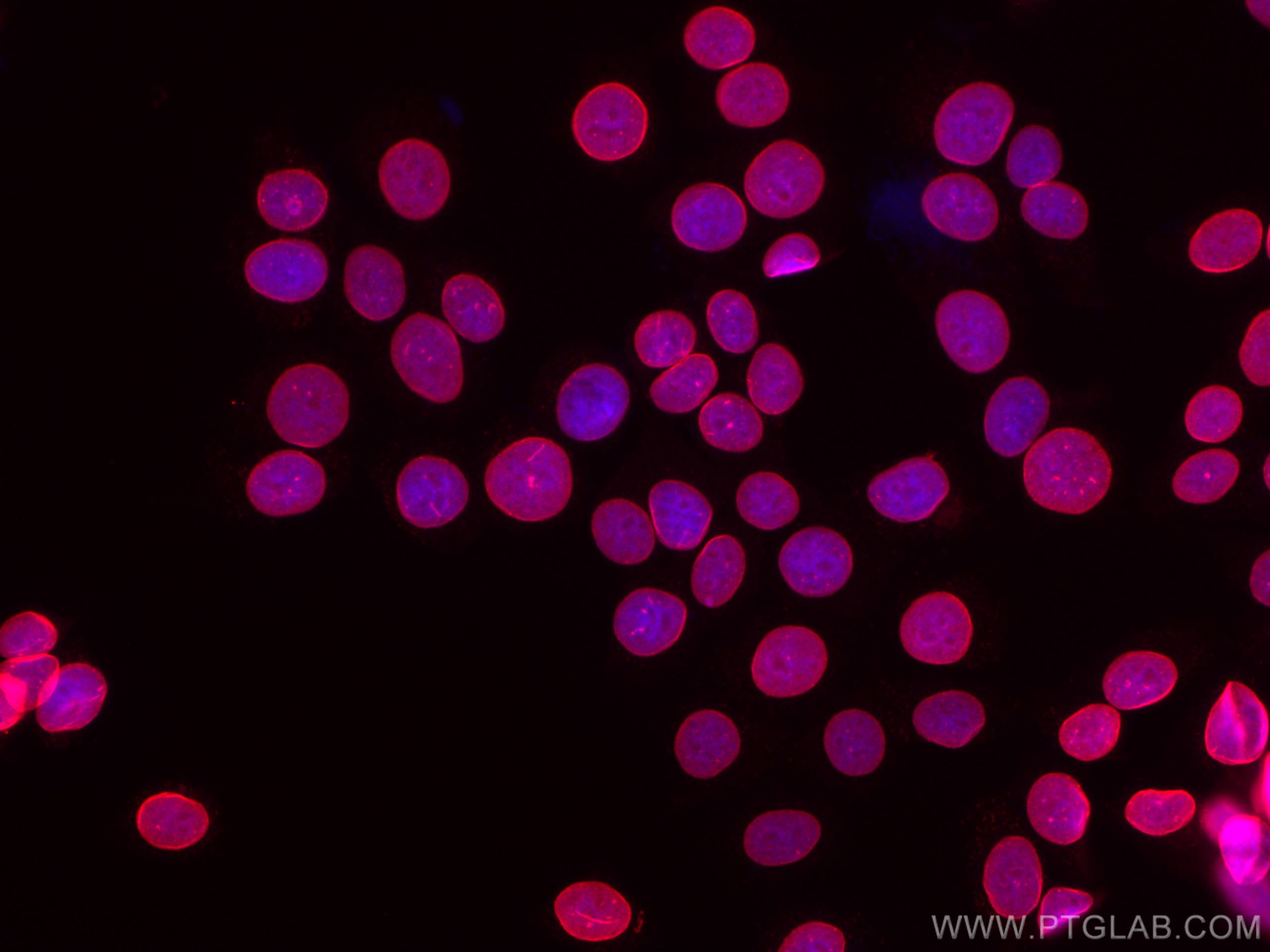 Immunofluorescence (IF) / fluorescent staining of MCF-7 cells using CoraLite®555-conjugated Lamin B1 Monoclonal antibo (CL555-66095)