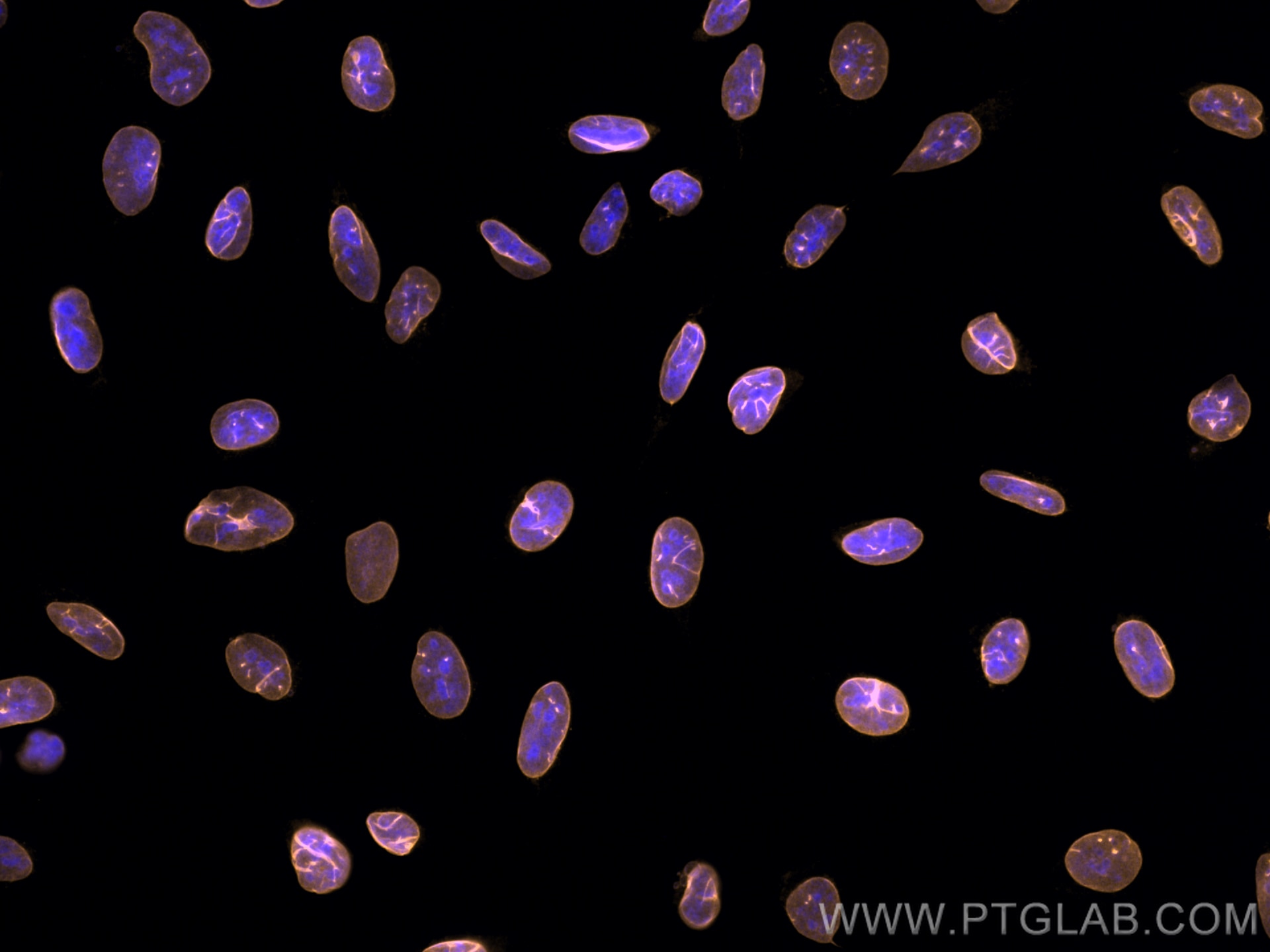 Immunofluorescence (IF) / fluorescent staining of U2OS cells using CoraLite®555-conjugated Lamin B1 Monoclonal antibo (CL555-66095)