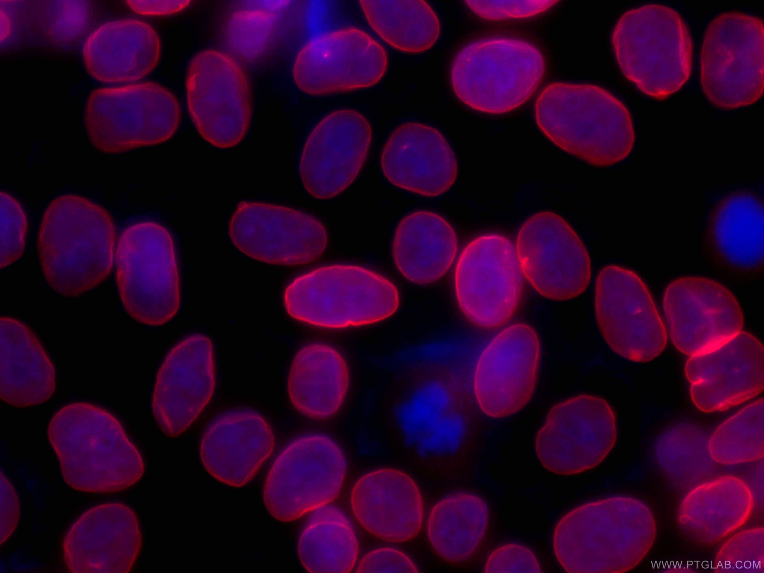 IF Staining of HepG2 using CL647-66095