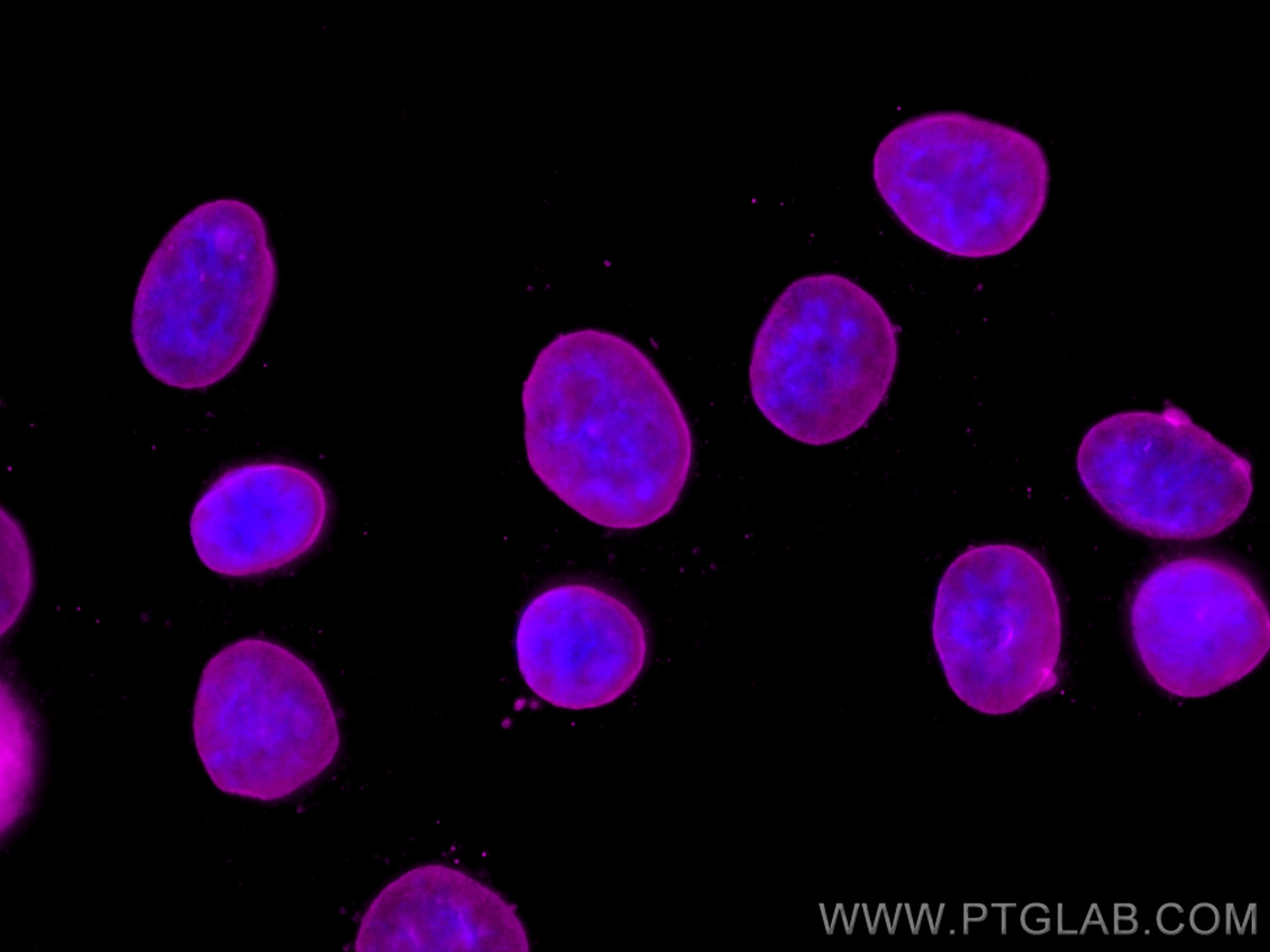 Immunofluorescence (IF) / fluorescent staining of HepG2 cells using CoraLite® Plus 647-conjugated Lamin B1 Monoclonal  (CL647-66095)
