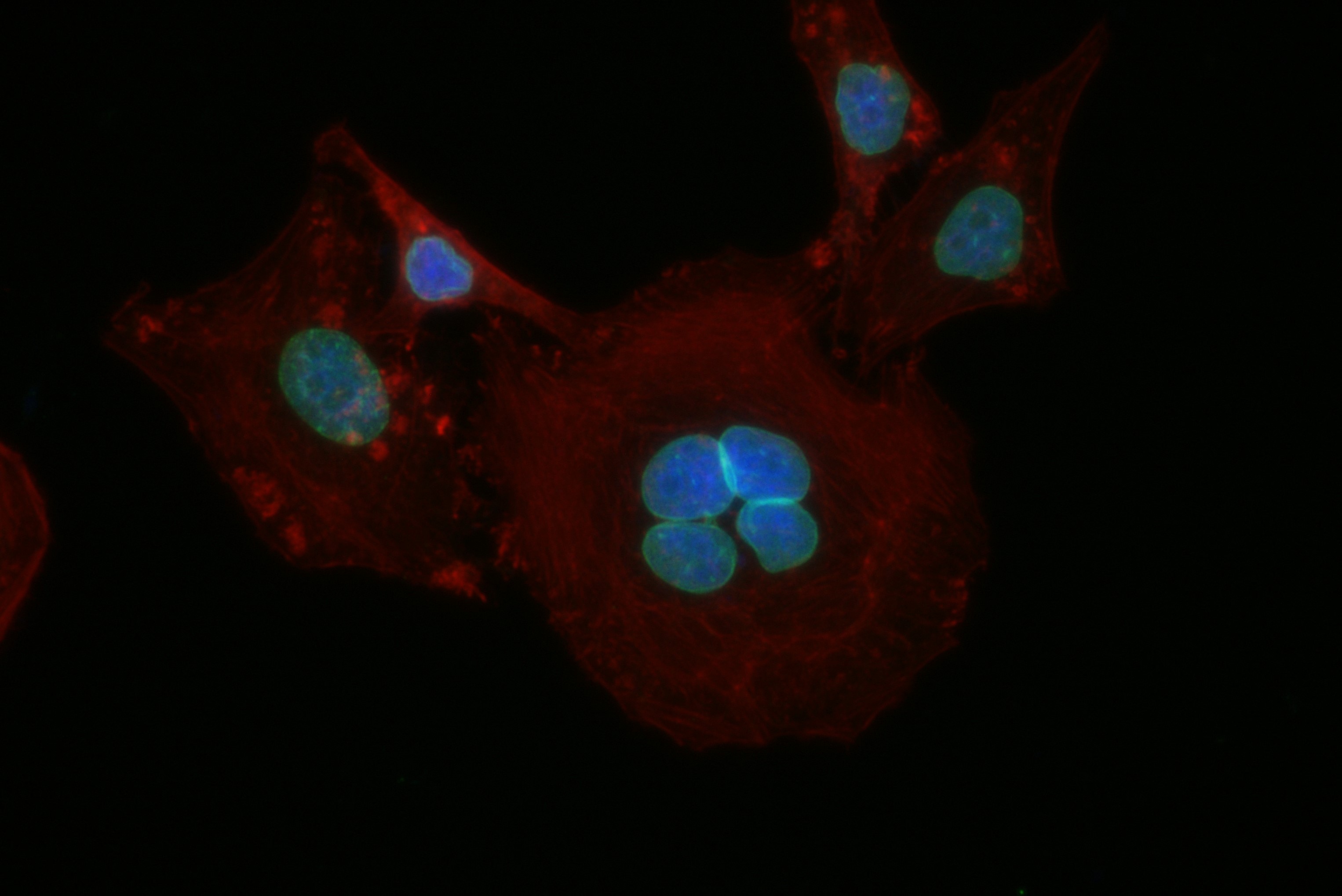 IF Staining of HepG2 using 82801-2-RR