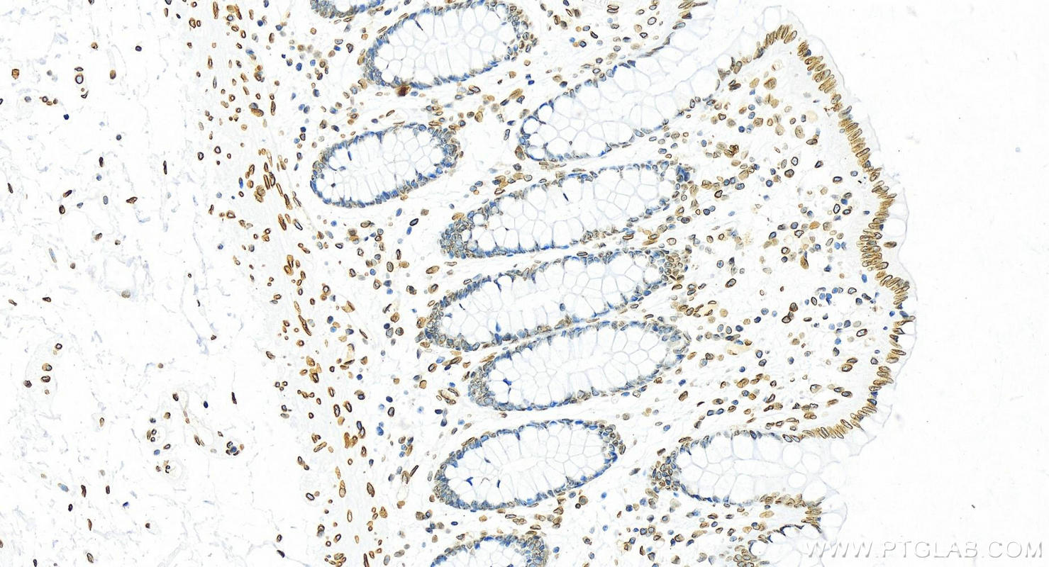 Immunohistochemical analysis of paraffin-embedded human colon tissue slide using 82801-4-RR (Lamin B2 antibody) at dilution of 1:2000 (under 20x lens). Heat mediated antigen retrieval with Tris-EDTA buffer (pH 9.0). This data was developed using the same antibody clone with 82801-4-PBS in a different storage buffer formulation. Immunohistochemistry (IHC) staining of human colon tissue using Lamin B2 Recombinant monoclonal antibody (82801-4-RR)