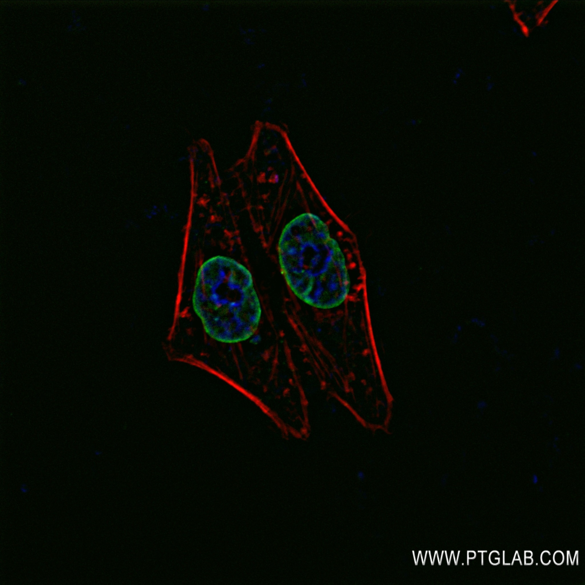 IF Staining of HepG2 using 82801-4-RR