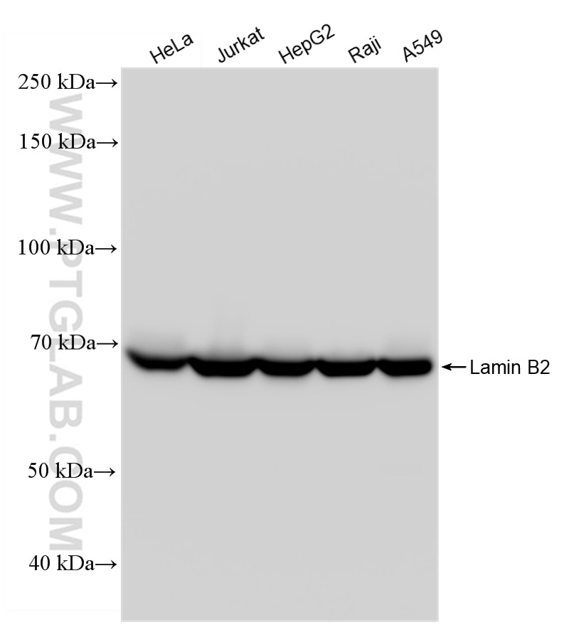 WB analysis using 82801-4-RR