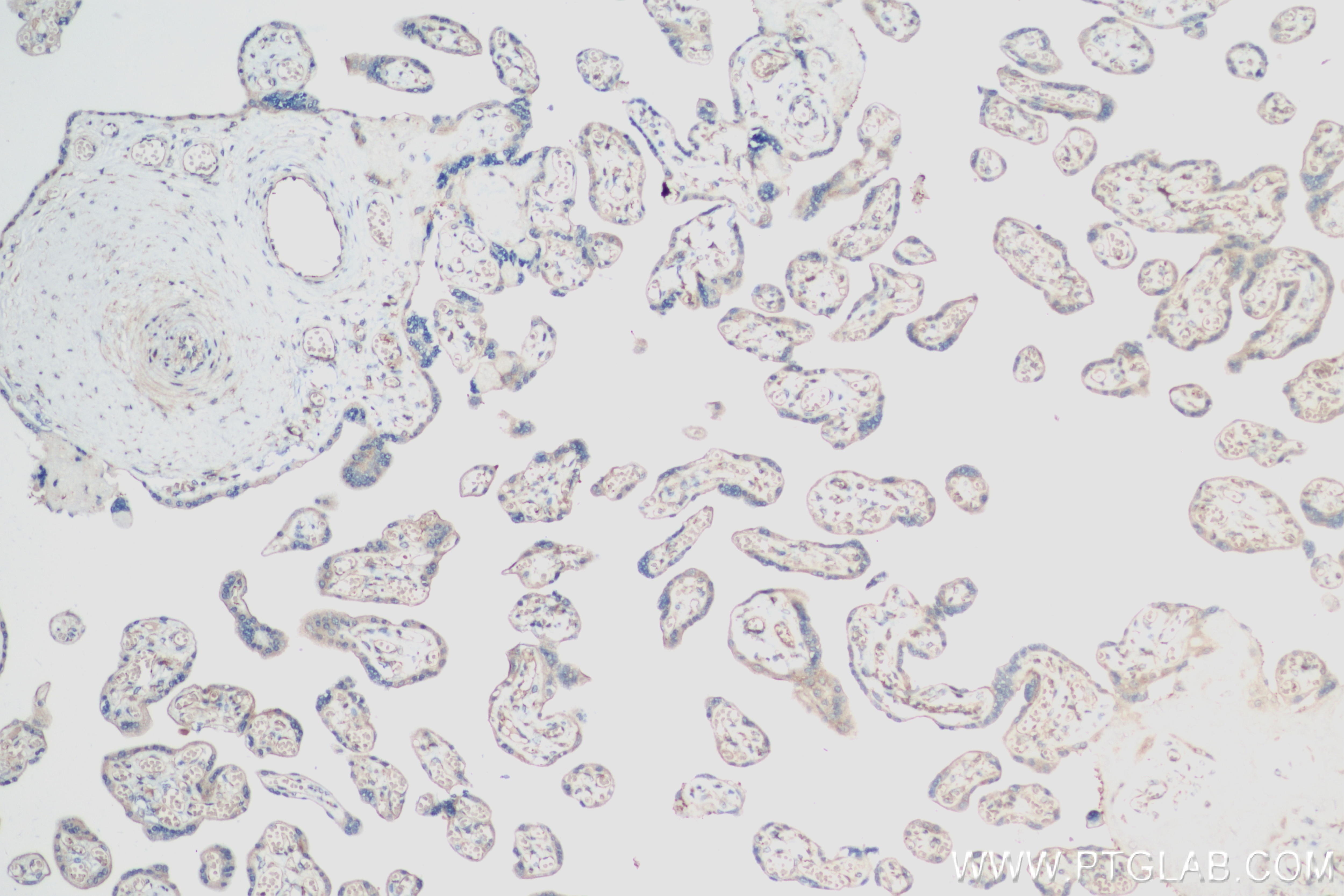 Immunohistochemistry (IHC) staining of human placenta tissue using Leptin Recombinant antibody (83655-3-RR)