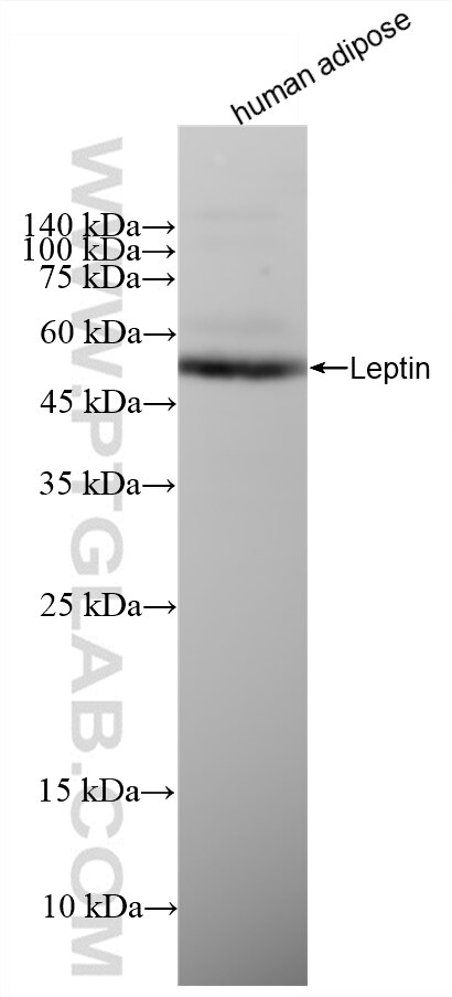 WB analysis of human adipose using 83655-3-RR Western Blot (WB) analysis of human adipose tissue using Leptin Recombinant monoclonal antibody (83655-3-RR)