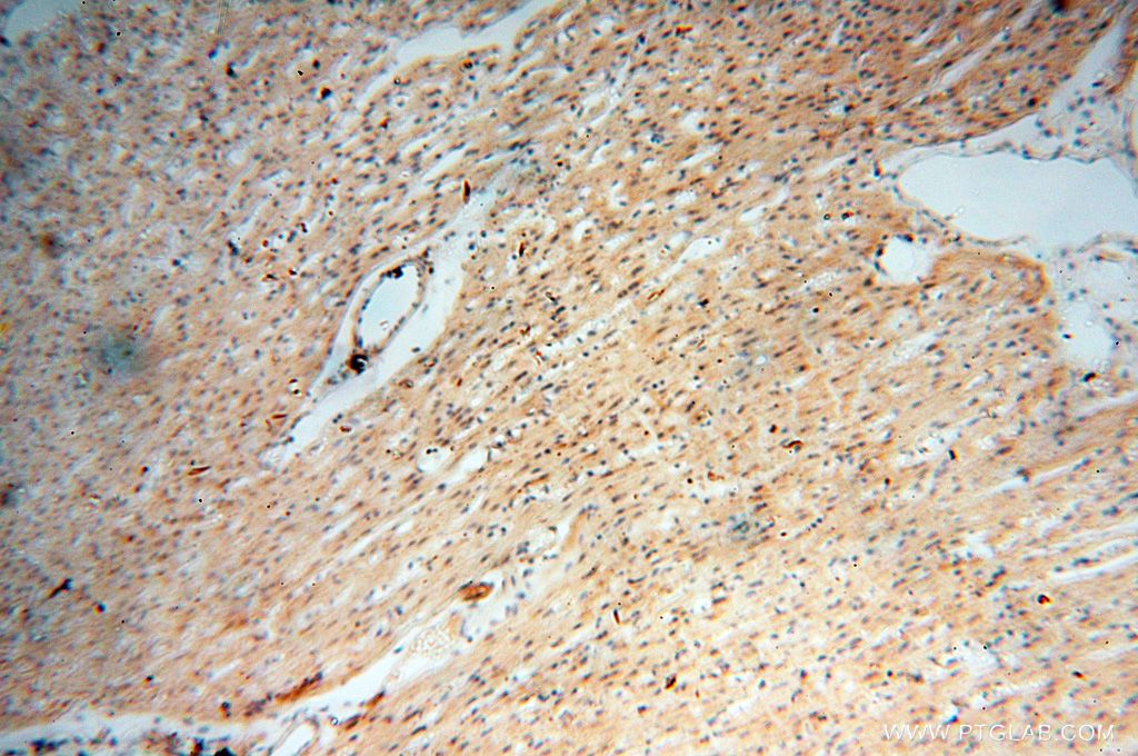 Immunohistochemistry (IHC) staining of human heart tissue using Lin28A-specific Polyclonal antibody (16177-1-AP)