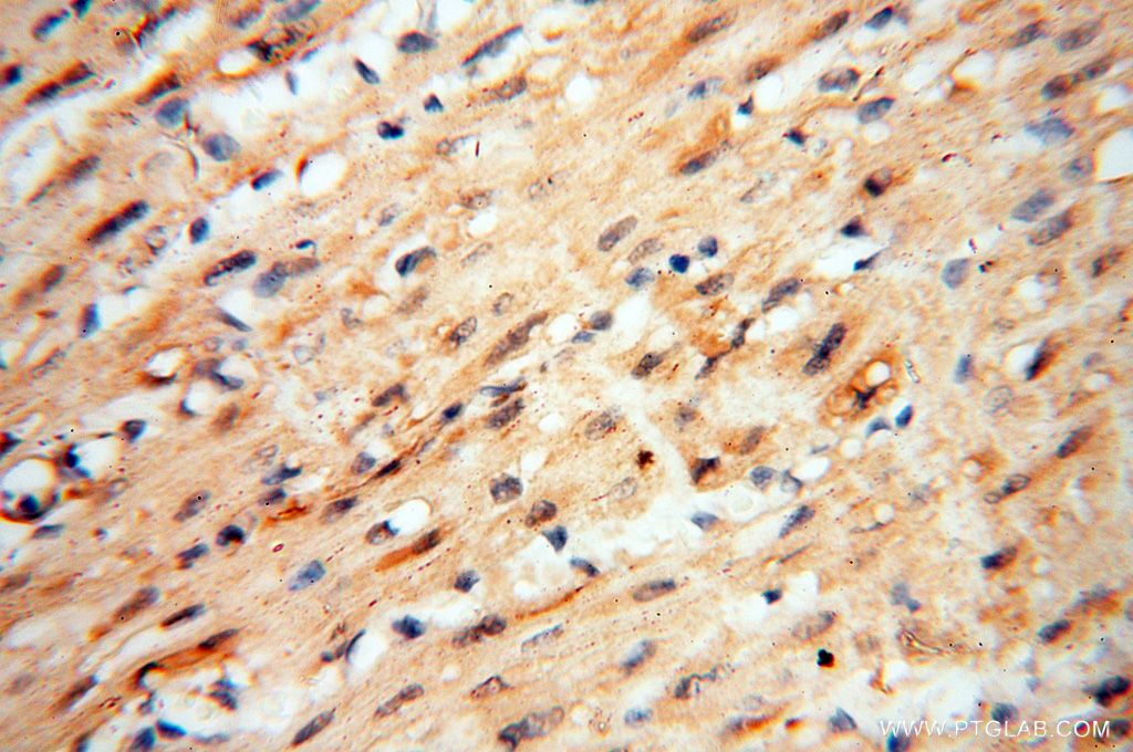 IHC staining of human heart using 16177-1-AP