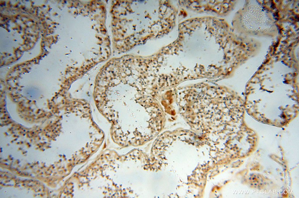 Immunohistochemistry (IHC) staining of human testis tissue using Lin28A-specific Polyclonal antibody (16177-1-AP)