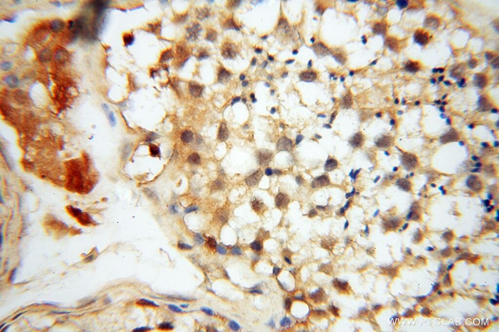 IHC staining of human testis using 16177-1-AP