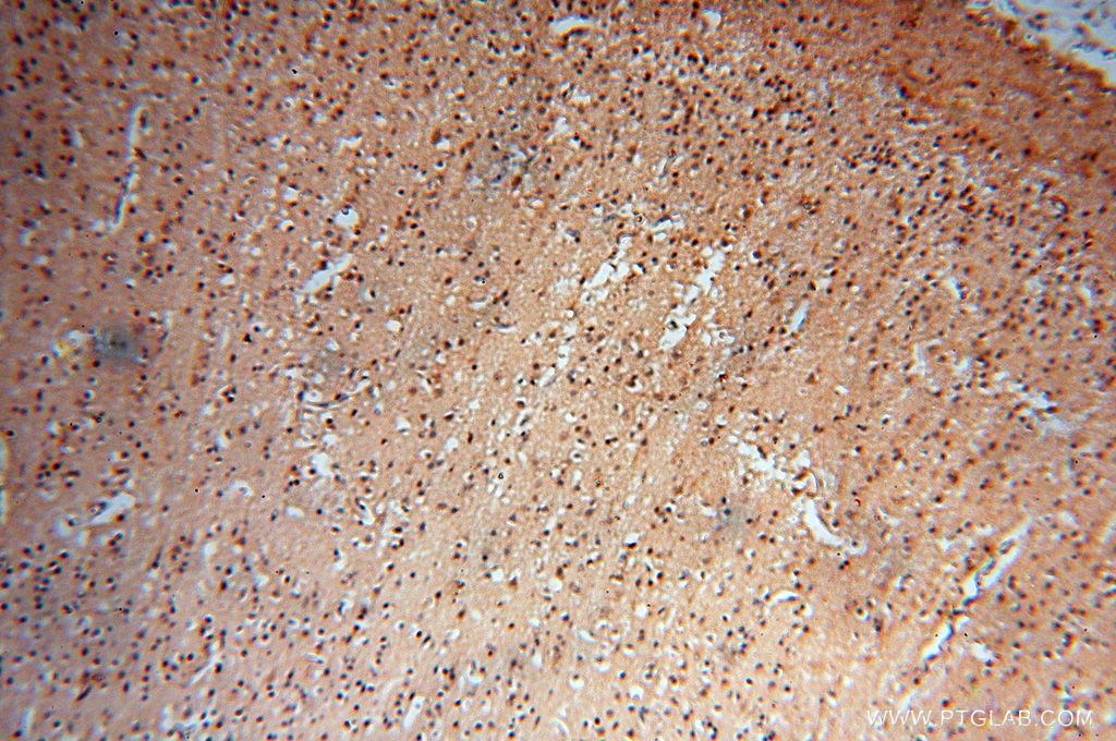 Immunohistochemistry (IHC) staining of human brain tissue using Lin28A-specific Polyclonal antibody (16177-1-AP)