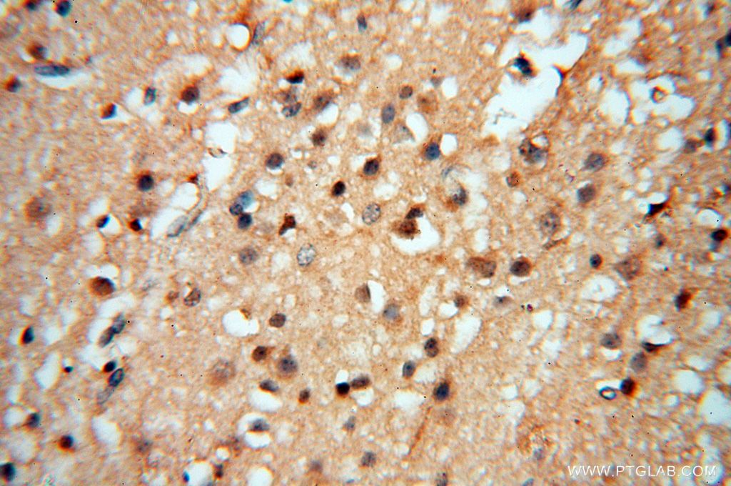 Immunohistochemistry (IHC) staining of human brain tissue using Lin28A-specific Polyclonal antibody (16177-1-AP)