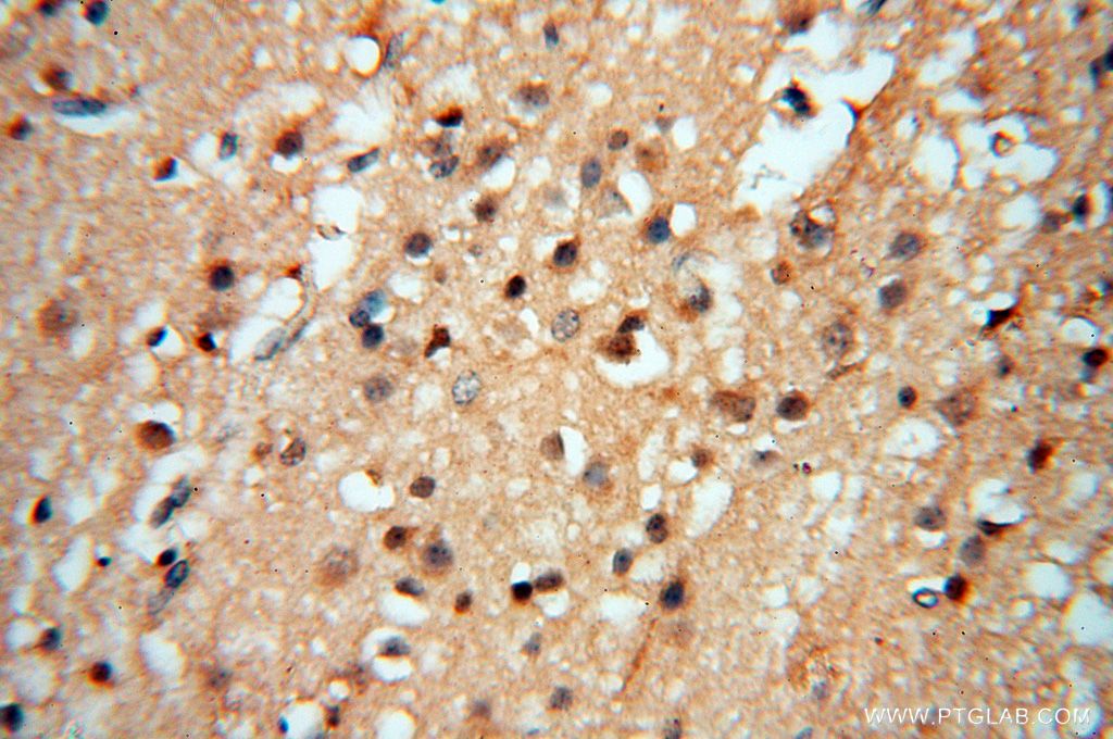 IHC staining of human brain using 16177-1-AP