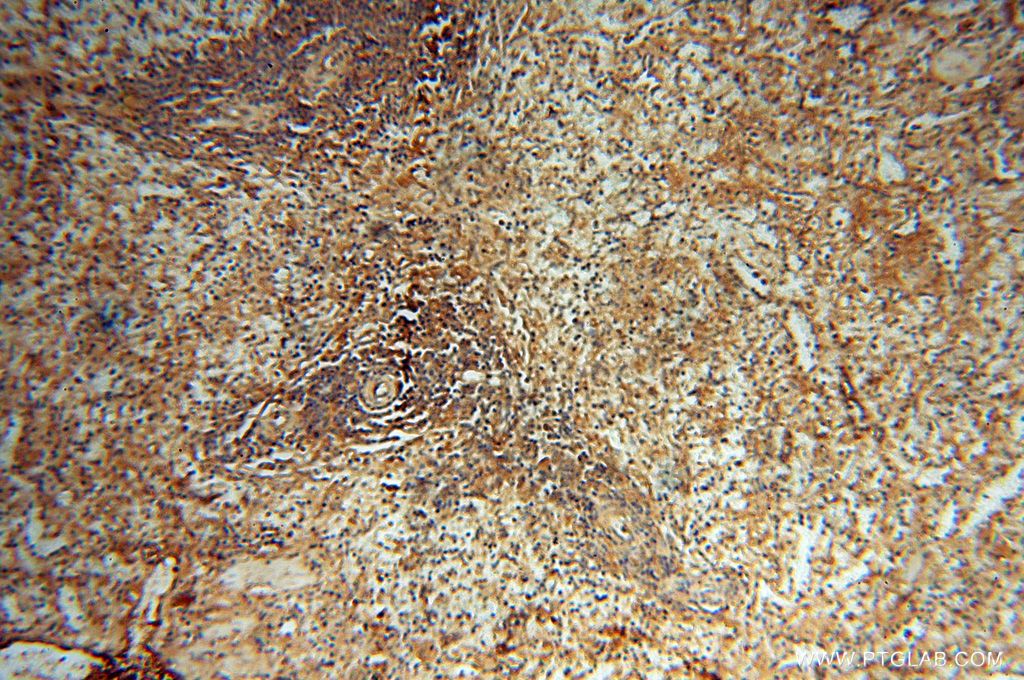 Immunohistochemistry (IHC) staining of human spleen tissue using Lin28A-specific Polyclonal antibody (16177-1-AP)