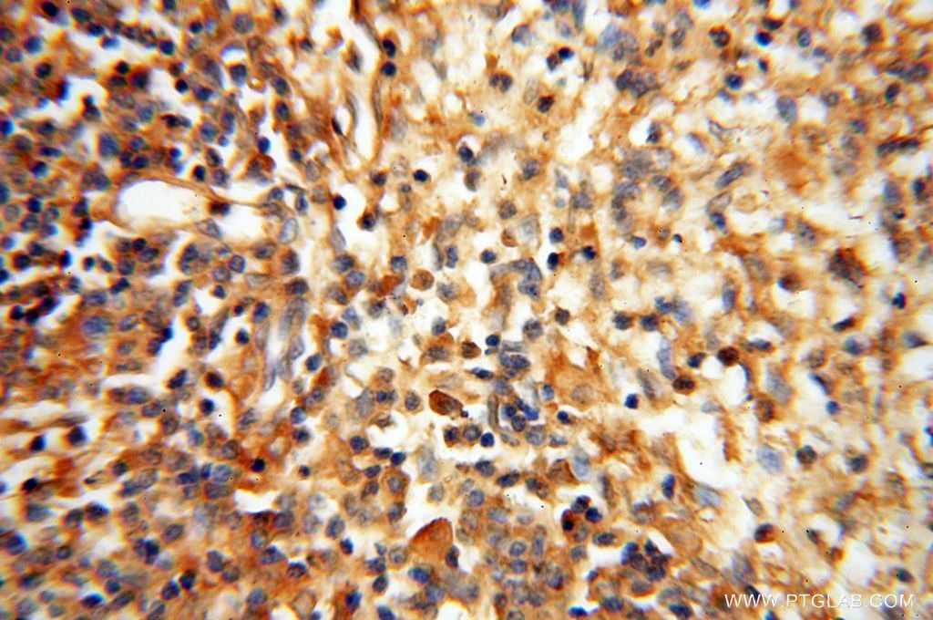 Immunohistochemistry (IHC) staining of human spleen tissue using Lin28A-specific Polyclonal antibody (16177-1-AP)
