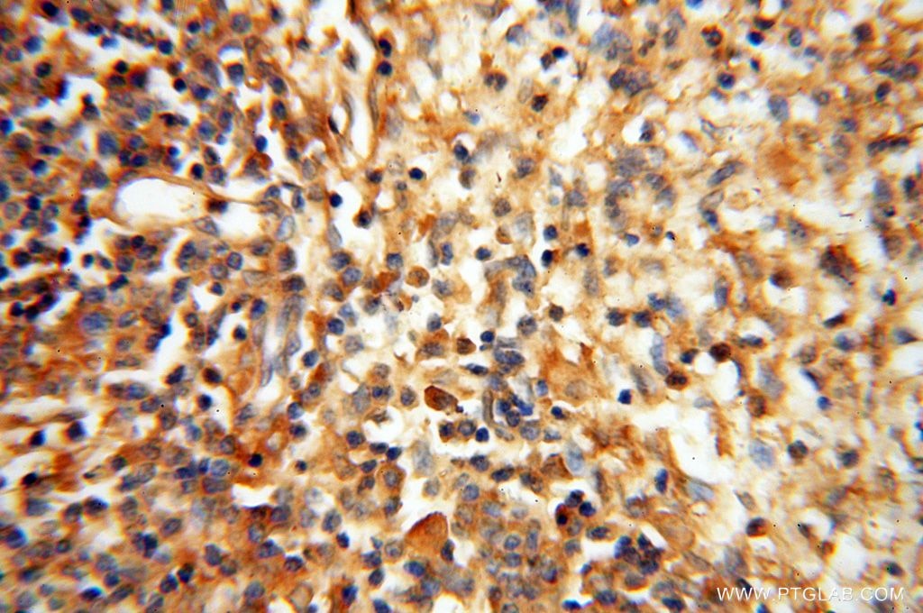 IHC staining of human spleen using 16177-1-AP