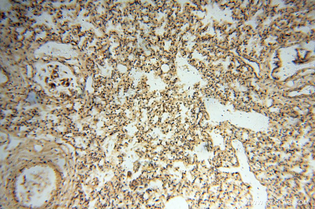 Immunohistochemistry (IHC) staining of human lung tissue using Lin28A-specific Polyclonal antibody (16177-1-AP)