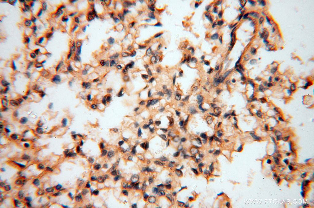 Immunohistochemistry (IHC) staining of human lung tissue using Lin28A-specific Polyclonal antibody (16177-1-AP)