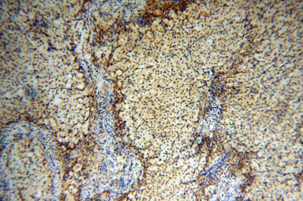Immunohistochemistry (IHC) staining of human ovary tissue using Lin28A-specific Polyclonal antibody (16177-1-AP)