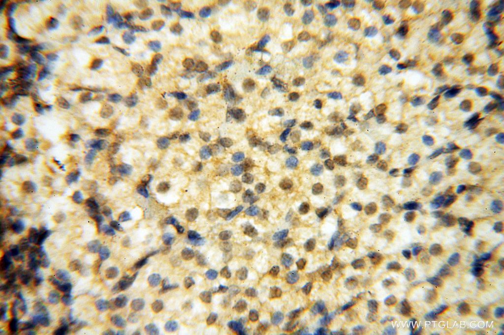 Immunohistochemistry (IHC) staining of human ovary tissue using Lin28A-specific Polyclonal antibody (16177-1-AP)