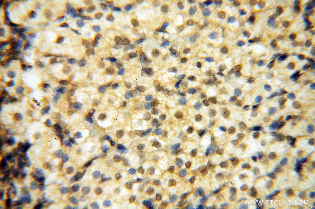 IHC staining of human ovary using 16177-1-AP