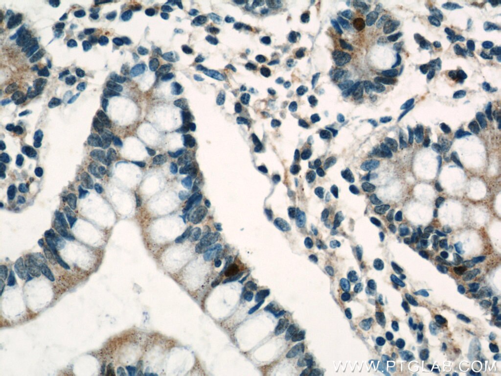 Immunohistochemistry (IHC) staining of human small intestine tissue using Lin28A-specific Polyclonal antibody (16177-1-AP)