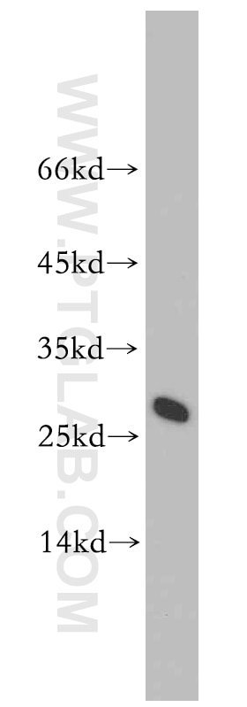 Western Blot (WB) analysis of mouse liver tissue using Lin28A-specific Polyclonal antibody (16177-1-AP)