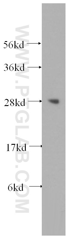 Lin28A-specific Polyclonal antibody