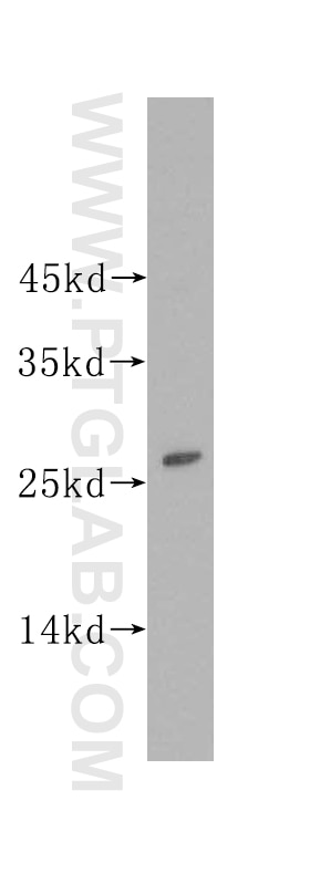 Western Blot (WB) analysis of human brain tissue using Lin28A-specific Polyclonal antibody (16177-1-AP)