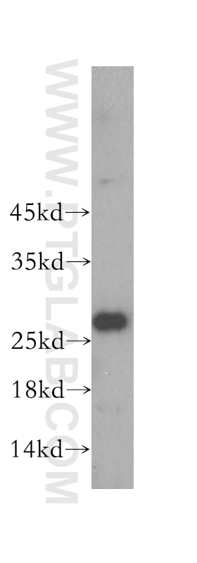 Western Blot (WB) analysis of human heart tissue using Lin28A-specific Polyclonal antibody (16177-1-AP)