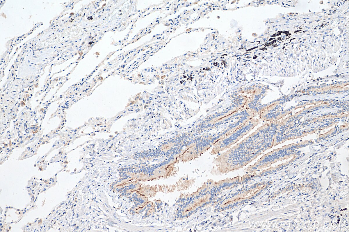 IHC staining of human lung using 16178-1-AP