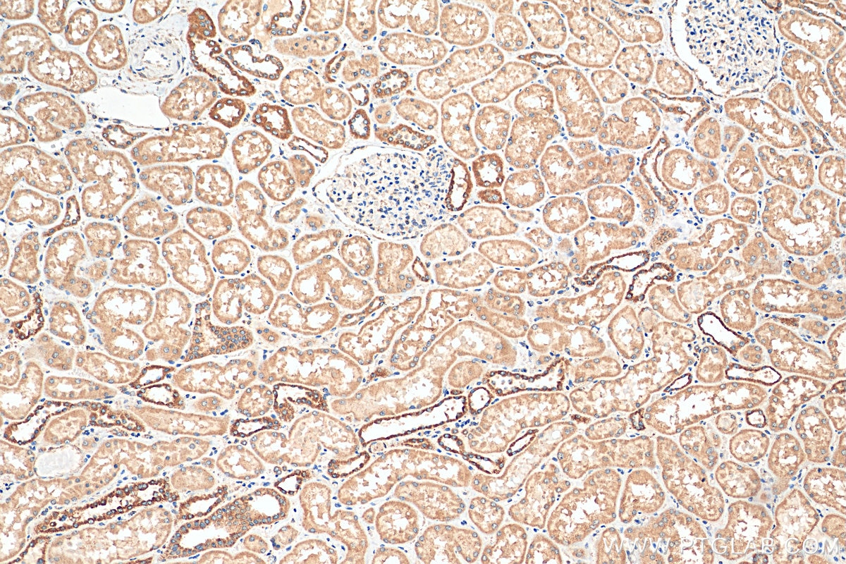 Immunohistochemistry (IHC) staining of human kidney tissue using Lin28B-specific Polyclonal antibody (16178-1-AP)