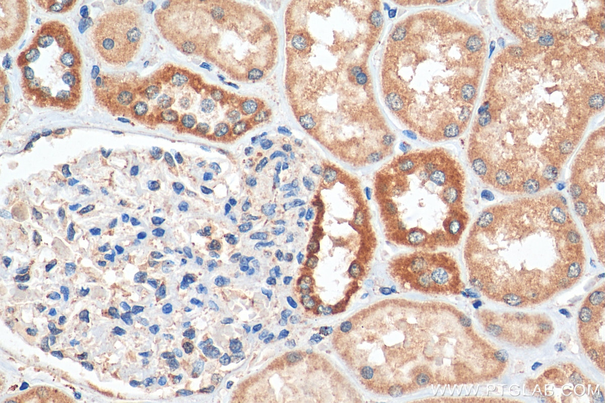 Immunohistochemistry (IHC) staining of human kidney tissue using Lin28B-specific Polyclonal antibody (16178-1-AP)