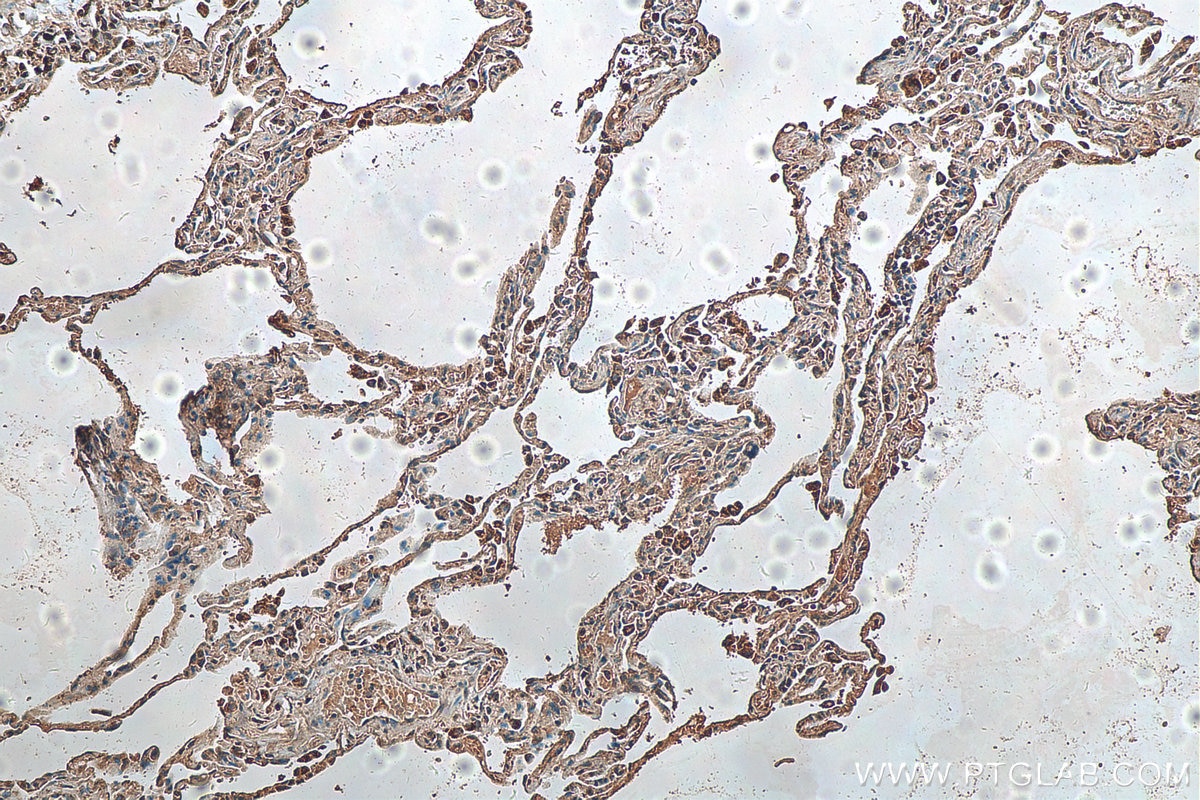 Immunohistochemistry (IHC) staining of human lung tissue using Lin28B-specific Polyclonal antibody (16178-1-AP)