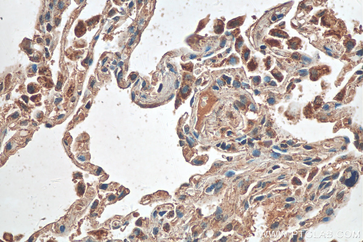 Immunohistochemistry (IHC) staining of human lung tissue using Lin28B-specific Polyclonal antibody (16178-1-AP)