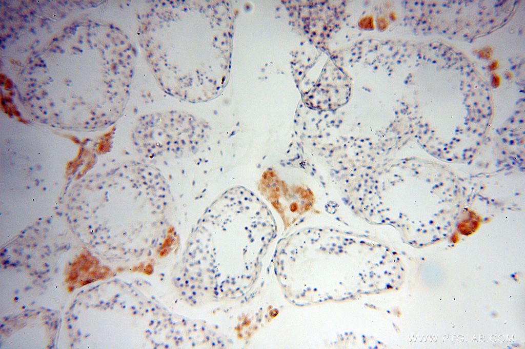 IHC staining of human testis using 16178-1-AP