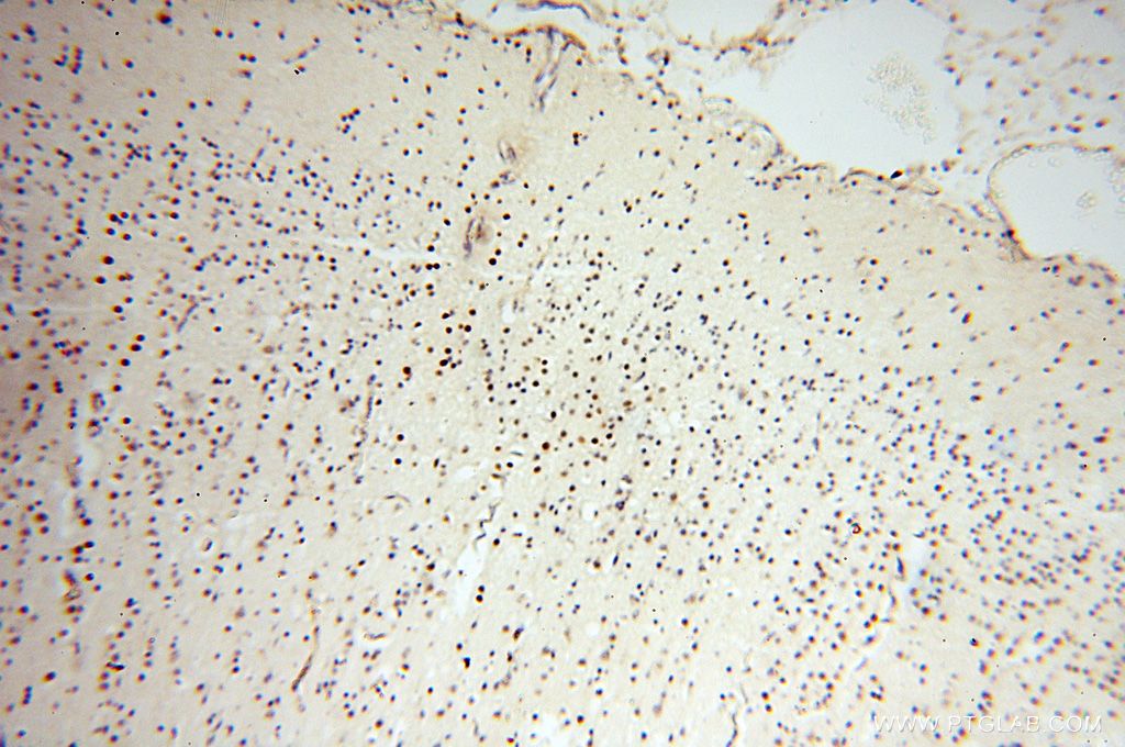 Immunohistochemistry (IHC) staining of human brain tissue using Lin28B-specific Polyclonal antibody (16178-1-AP)