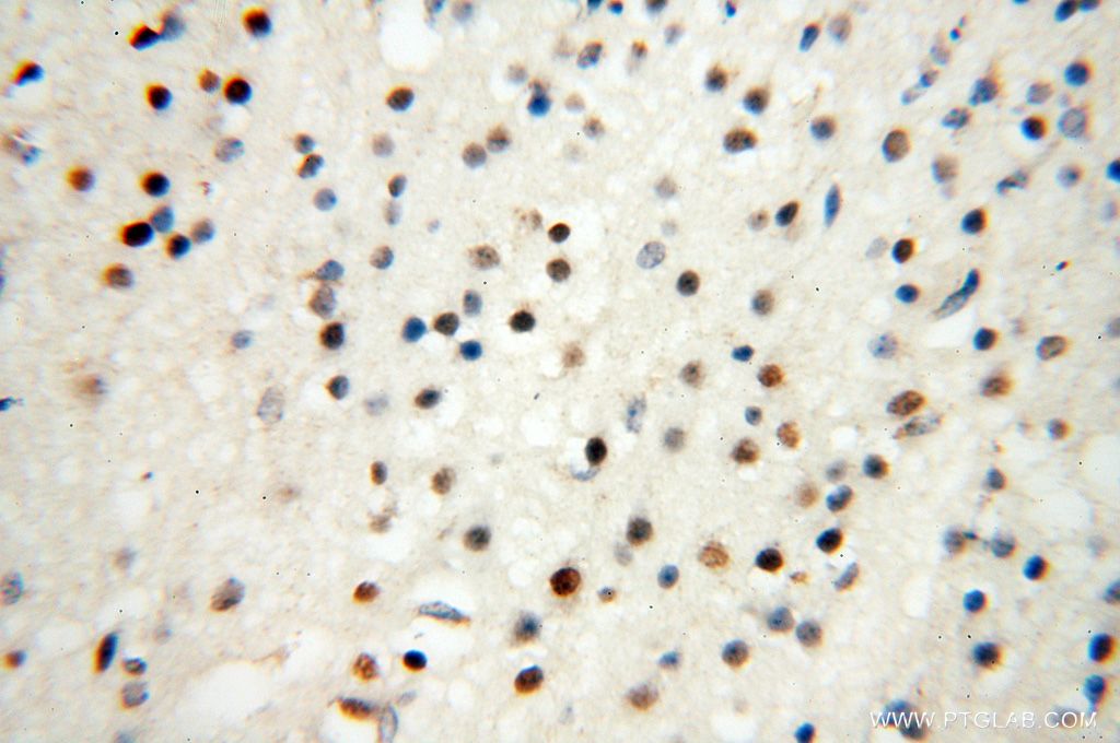 Immunohistochemistry (IHC) staining of human brain tissue using Lin28B-specific Polyclonal antibody (16178-1-AP)