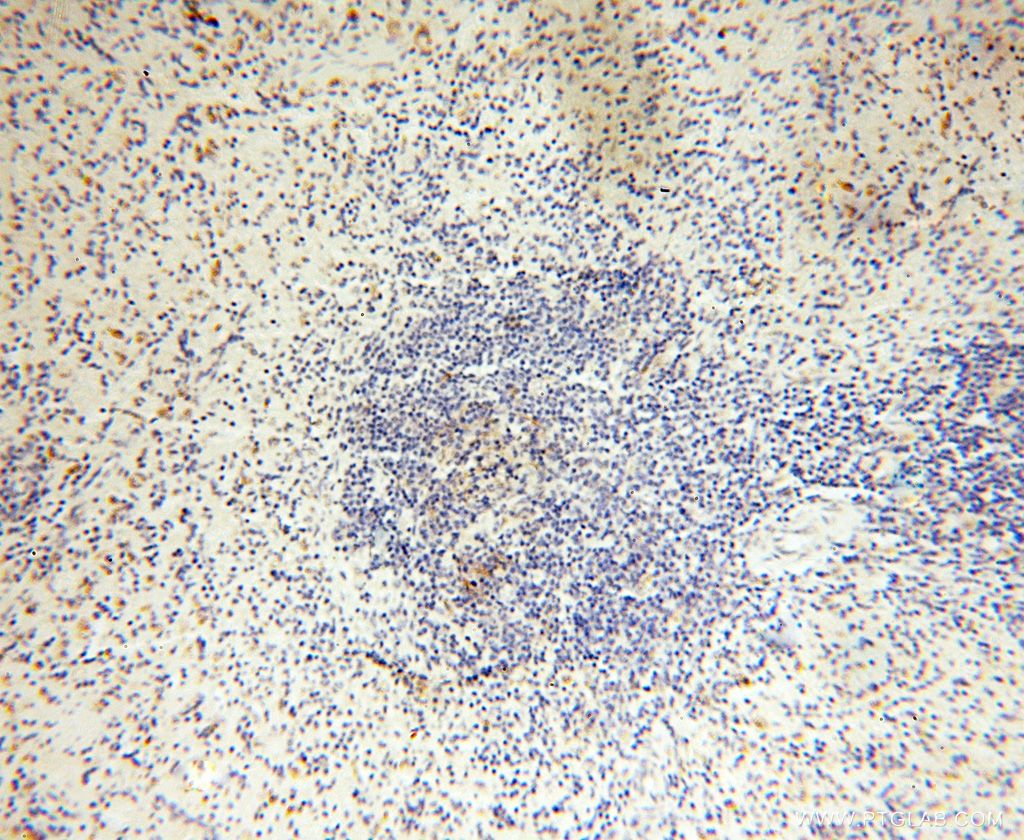 Immunohistochemistry (IHC) staining of human spleen tissue using Lin28B-specific Polyclonal antibody (16178-1-AP)