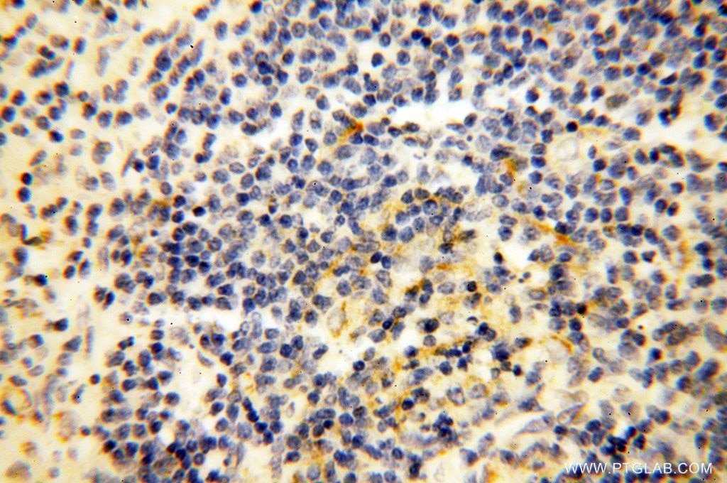 Immunohistochemistry (IHC) staining of human spleen tissue using Lin28B-specific Polyclonal antibody (16178-1-AP)