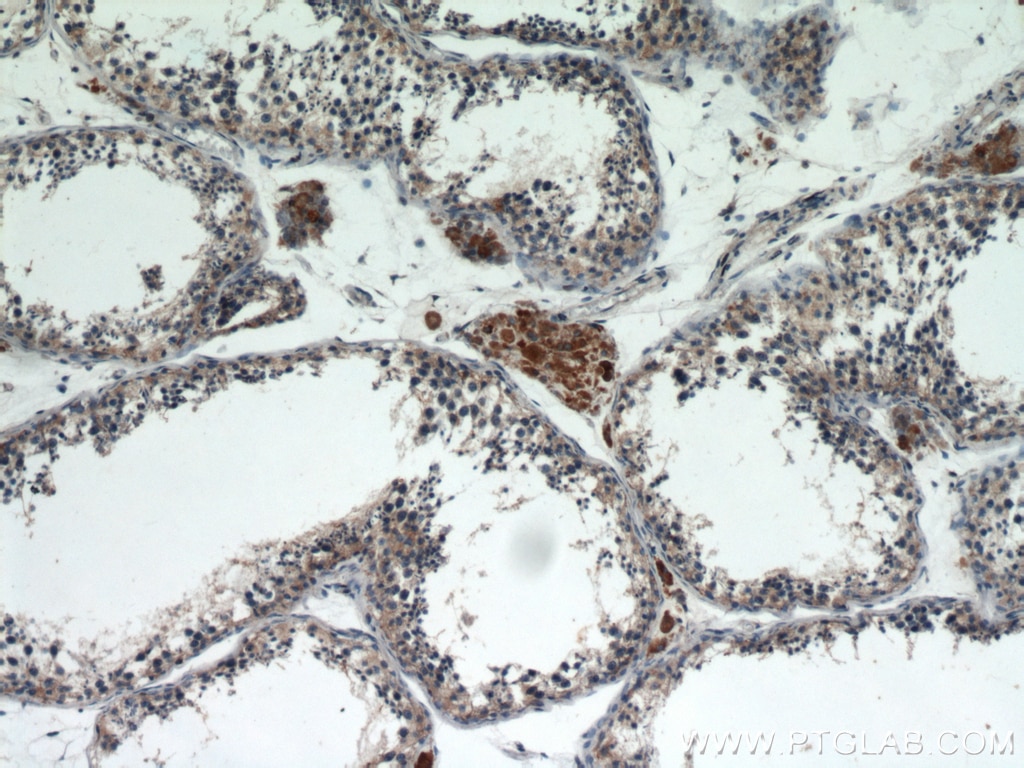 IHC staining of human testis using 16178-1-AP