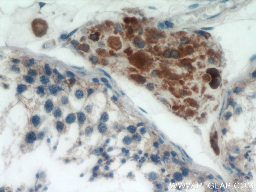 Immunohistochemistry (IHC) staining of human testis tissue using Lin28B-specific Polyclonal antibody (16178-1-AP)