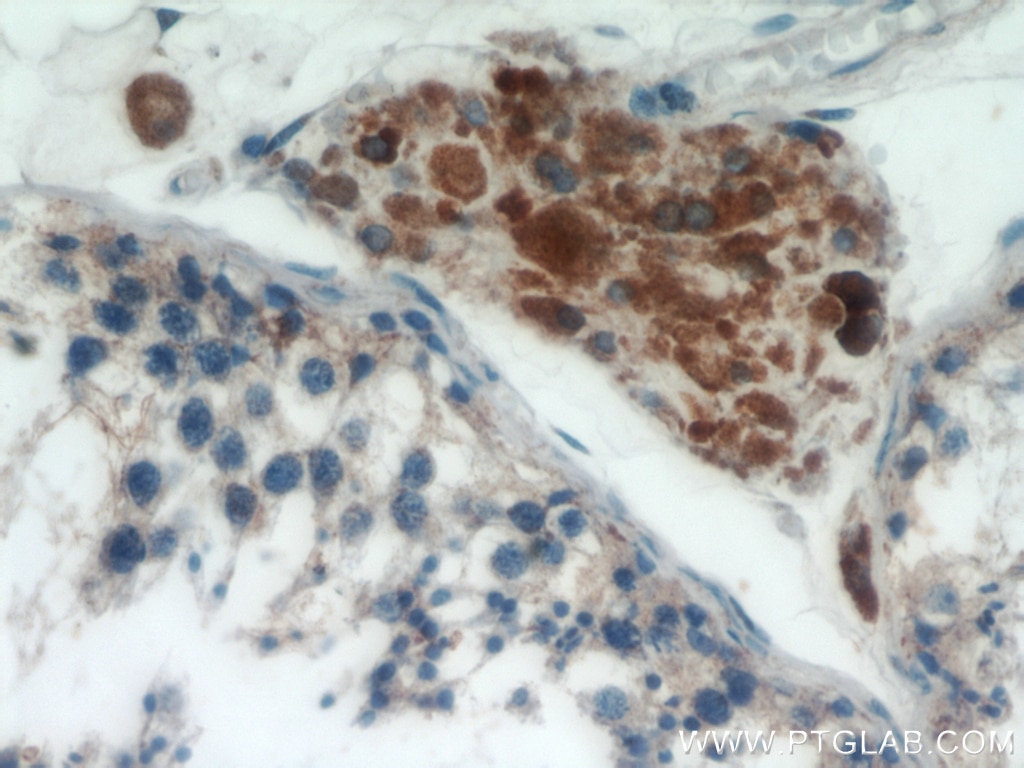 IHC staining of human testis using 16178-1-AP