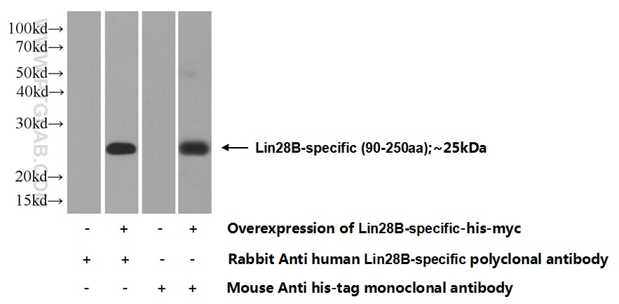 Lin28B-specific Polyclonal antibody