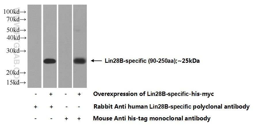 Lin28B-specific Polyclonal antibody