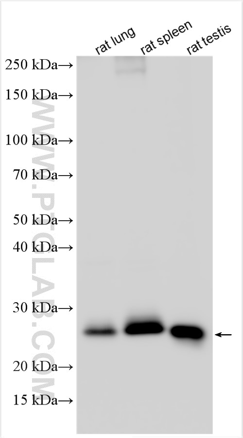 Western Blot (WB) analysis of various lysates using Lipocalin-2/NGAL Polyclonal antibody (31452-1-AP)