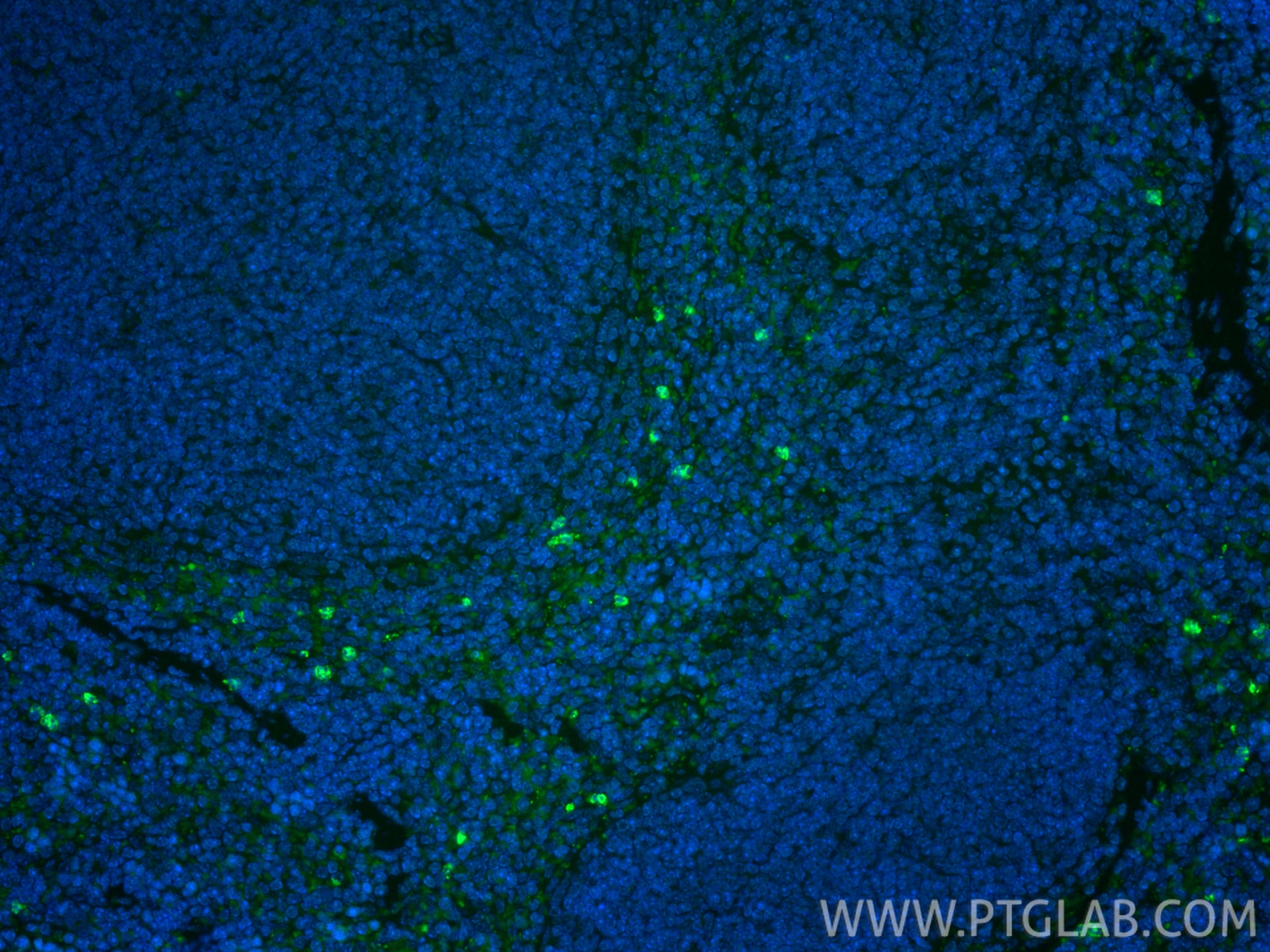 IF Staining of mouse spleen using 31721-1-AP Immunofluorescence (IF) / fluorescent staining of mouse spleen tissue using Lipocalin-2/NGAL Polyclonal antibody (31721-1-AP)