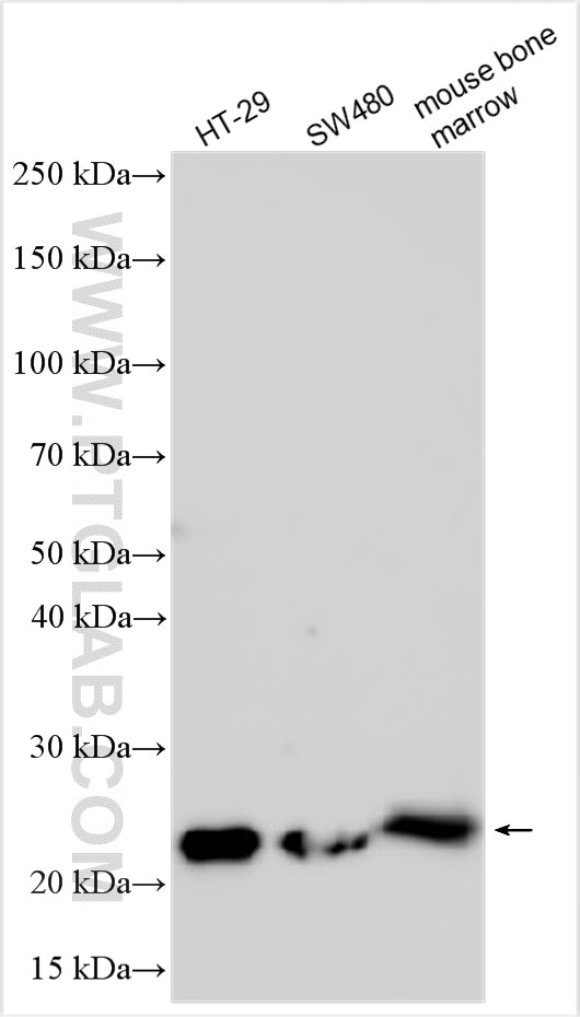 Western Blot (WB) analysis of various lysates using Lipocalin-2/NGAL Polyclonal antibody (31721-1-AP)